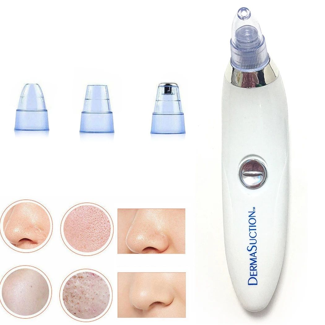 🔥4 IN 1 DERMA VACUUM 💁‍♀️🌞 SUCTION BLACKHEAD/ACNE/OIL/PORE CLEANER